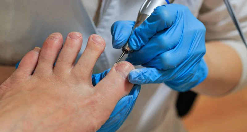 Maestría Cirugía de Mínima Incisión para Podólogos