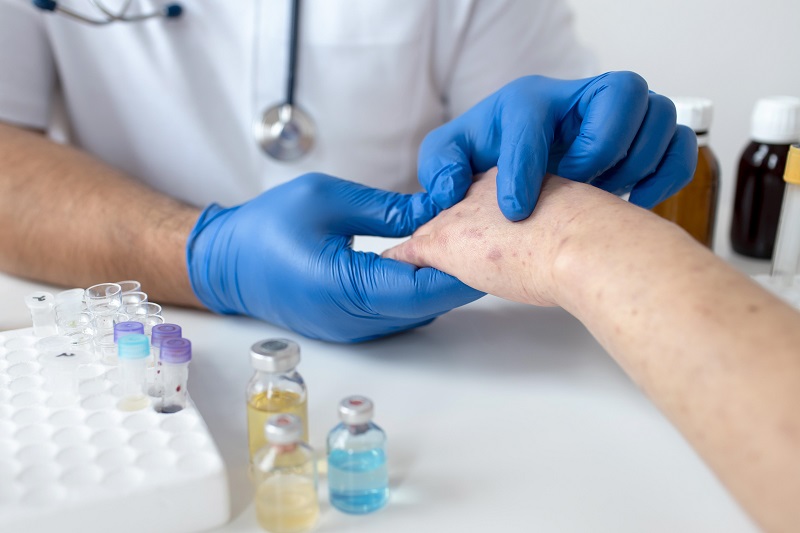 Especialista en Alergología - ISEIE