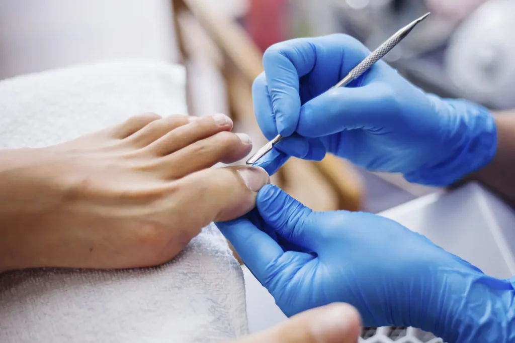 Diplomado en podología estética