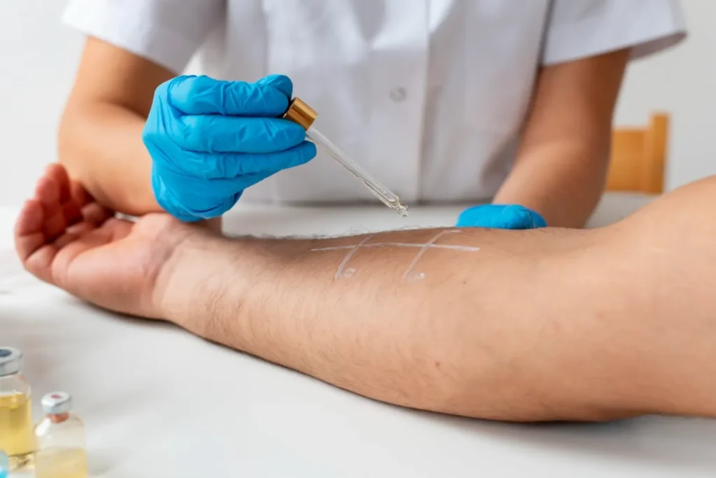 Maestría en Skin Barrier y Reparación Cutánea Microbioma y Barrera 1