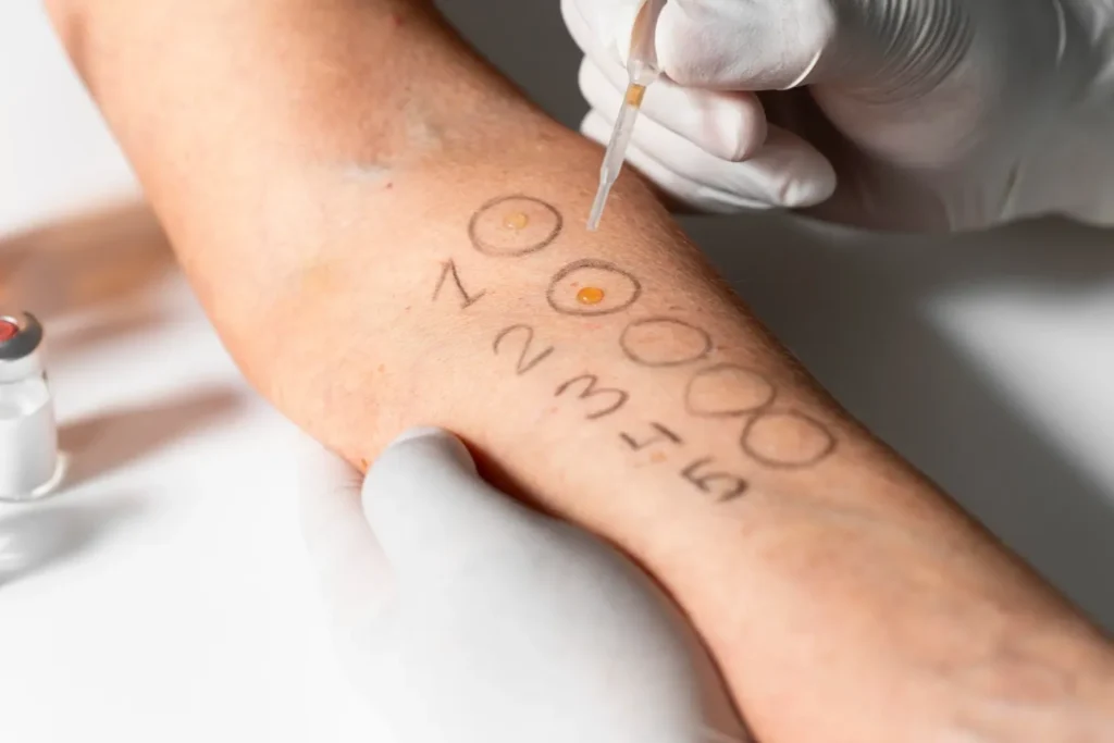 Maestría en Skin Barrier y Reparación Cutánea Microbioma y Barrera 2