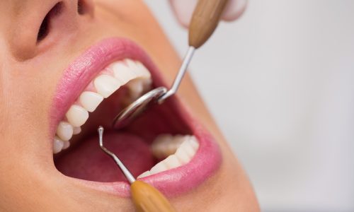 Diplomado en Odontología Estética