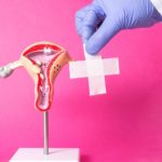 ISEIE-Master en estudios para Endometriosis