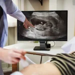 Maestria-en-Ecografia-de-Complicaciones-por-Rellenos-Diagnostico-y-Seguimiento-2